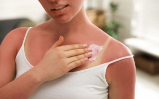 comment faire dérougir un coup de soleil