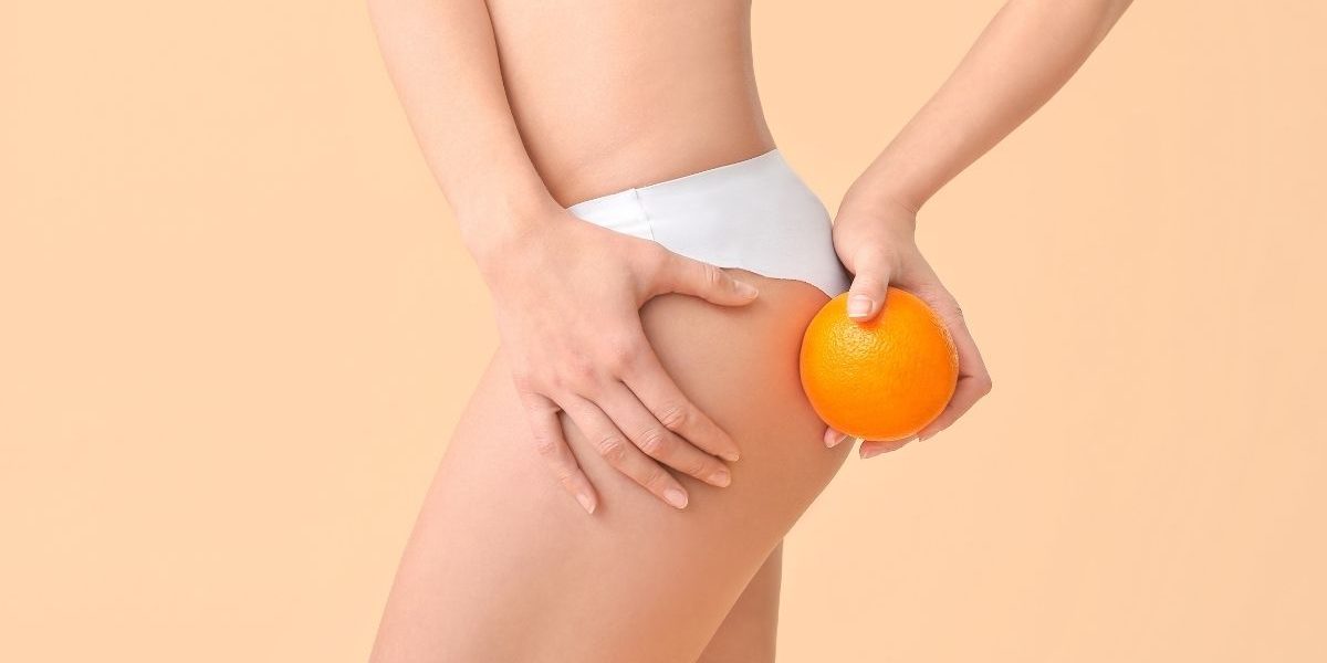 j'ai perdu toute ma cellulite femme qui n'a plus de peau d'orange