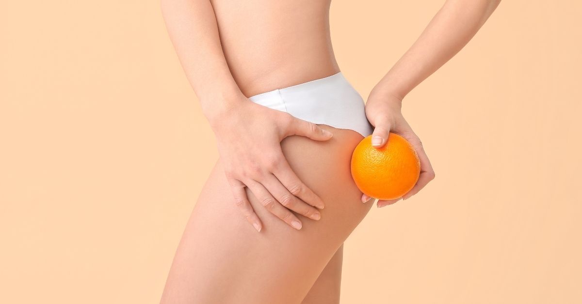 j'ai perdu toute ma cellulite femme qui n'a plus de peau d'orange